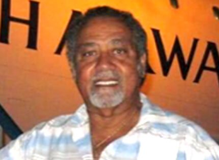Mickey Stanley is on the mend after freak accident in Barbados